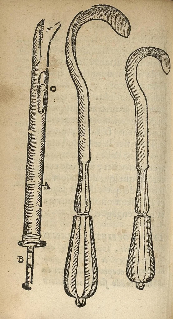 An illustration from L'accoucheur methodique, qui enseigne la maniere d'operer dans tous les accouchements naturels et artificiels..., 1676, leaf 383