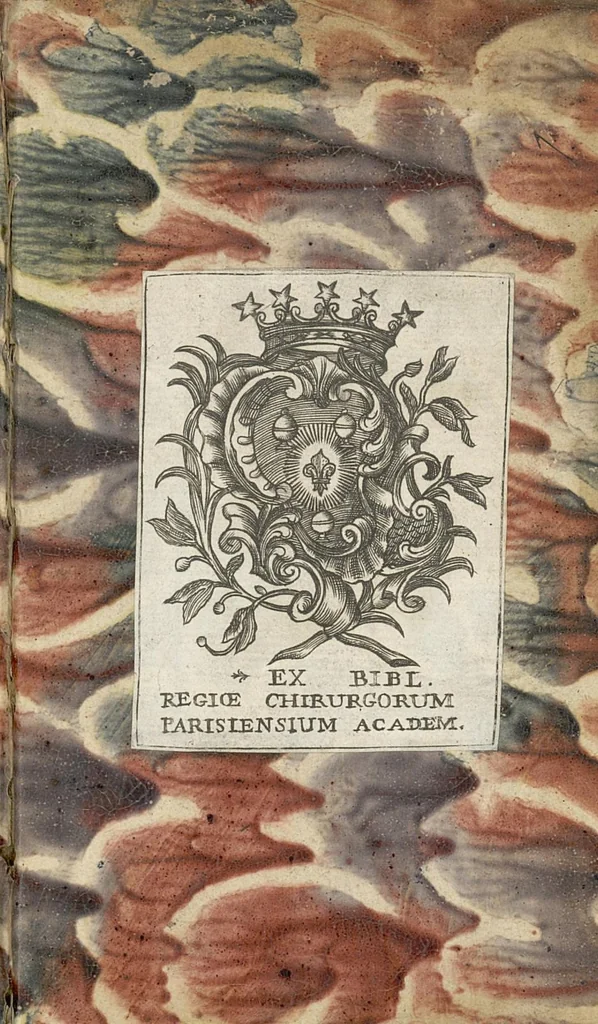 An illustration from Recit exact d'une grossesse extraordinaire observée à l'Hôtel-Dieu de Paris, 1698, leaf 112