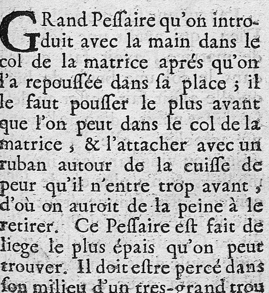 An illustration from L' appareil commode en faveur des jeunes chirurgiens, 1700, leaf 233