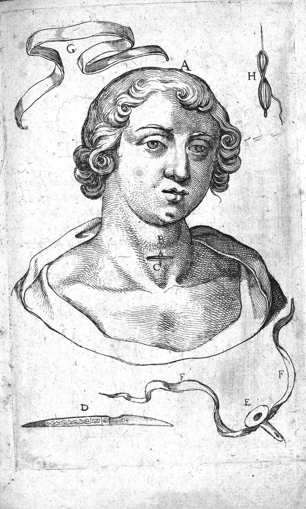 An illustration from Question chirurgicale par laquelle il est démontré que le chirurgien doit assurement pratiquer l'operation de la bronchotomie,..., 1620, leaf 12