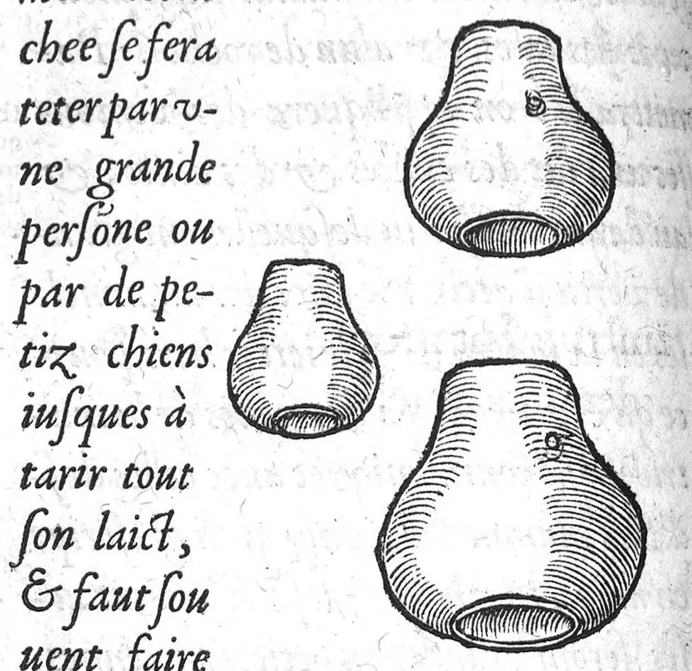 An illustration from Deux livres de chirurgie, I. De la generation de l’homme, et maniere d’extraire les enfans hors du ventre de la mere, ensemble ce qu’il faut faire pour la faire mieux, et plus tost accoucher, avec la cure de plusieurs maladies qui luy peuvent survenir. 2. Des monstres tant terrestres que marins, avec leurs portrait. Plus un petit traité des plaies faites aux parties nerveuses. Par Ambroise Paré, premier Chirurgien du Roy, et juré à Paris,, 1573, leaf 175