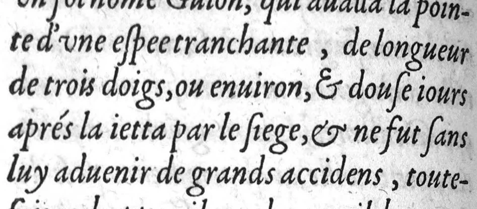 An illustration from Deux livres de chirurgie, I. De la generation de l’homme, et maniere d’extraire les enfans hors du ventre de la mere, ensemble ce qu’il faut faire pour la faire mieux, et plus tost accoucher, avec la cure de plusieurs maladies qui luy peuvent survenir. 2. Des monstres tant terrestres que marins, avec leurs portrait. Plus un petit traité des plaies faites aux parties nerveuses. Par Ambroise Paré, premier Chirurgien du Roy, et juré à Paris,, 1573, leaf 479