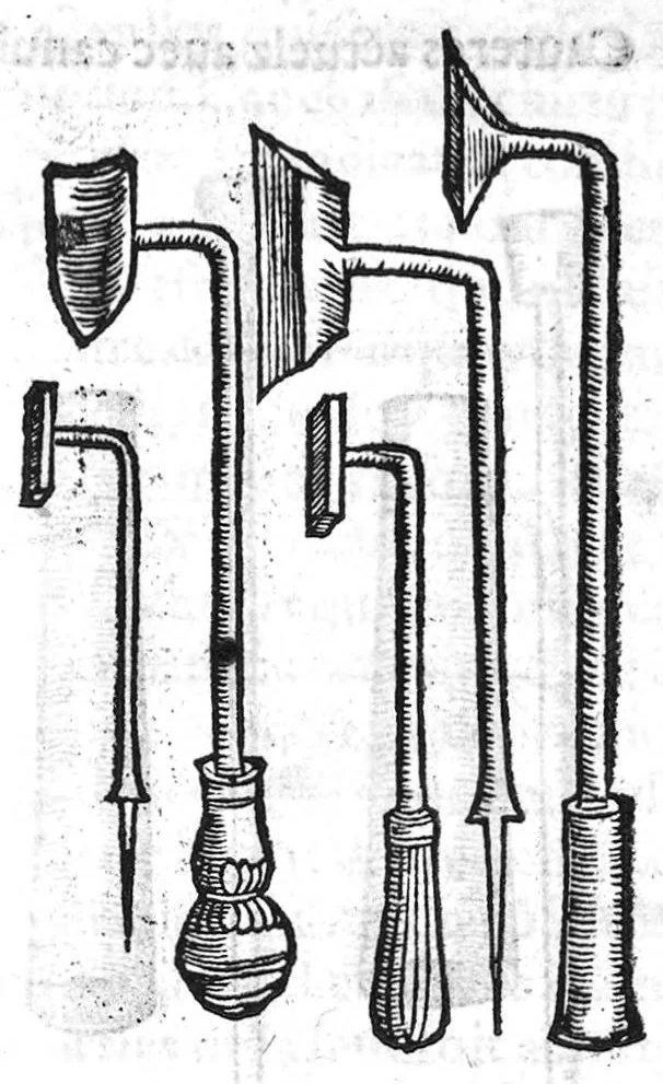 An illustration from La maniere de traicter les playes faictes tant par hacquebutes, que par fleches : et les accidentz d’icelles, comme fractures et caries des os, gangrene et mortification : avec les pourtraictz des instrumentz necessaires pour leur curation. Et la methode de curer les combustions principalement faictes par la pouldre à canon. Le tout composé par Ambroise Paré, maistre Barbier Chirurgien à Paris, 1552, leaf 94