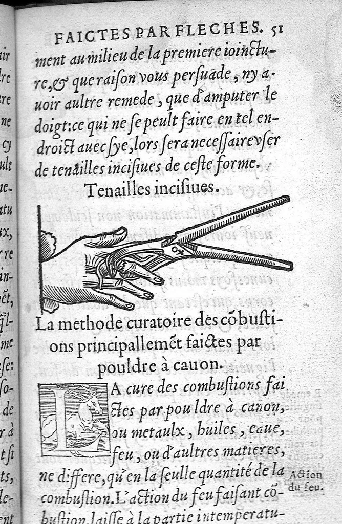 An illustration from La Méthode de traicter les playes faictes par hacquebutes et aultres bastons à feu et de celles qui sont faictes par flèches, dardz et semblables, aussy des combustions spécialement faictes par la pouldre à canon, composée par Ambroyse Paré,..., 1545, leaf 101