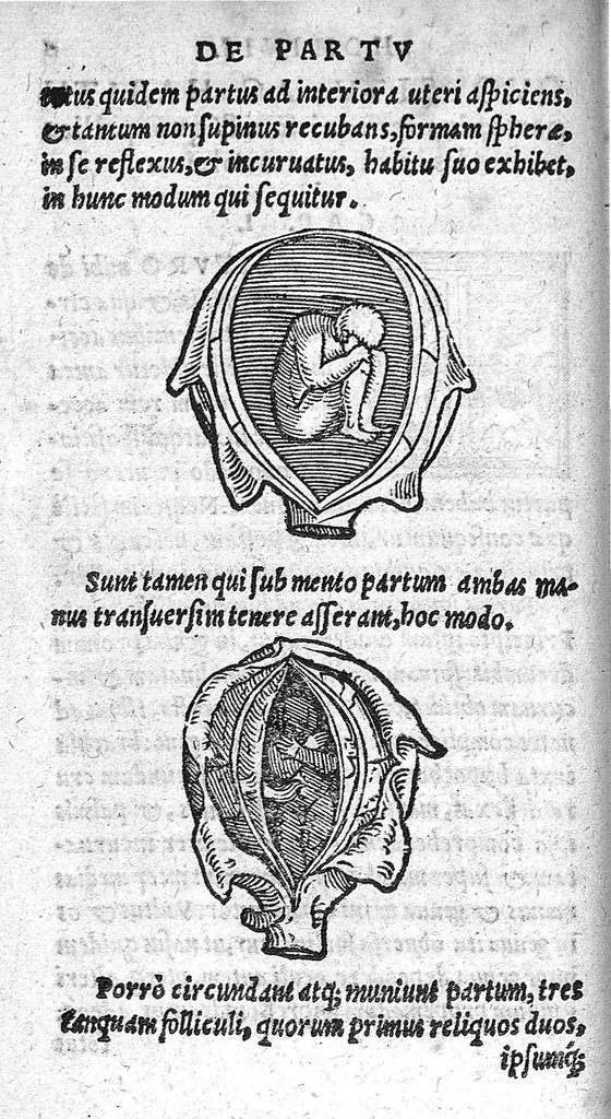 An illustration from De partu hominis, 1556, leaf 11