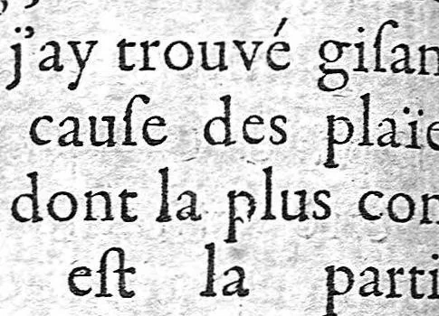 An illustration from La doctrine des raports de chirurgie fondée sur les maximes d'usage et sur la disposition des nouvelles ordonnances, 1684, leaf 148