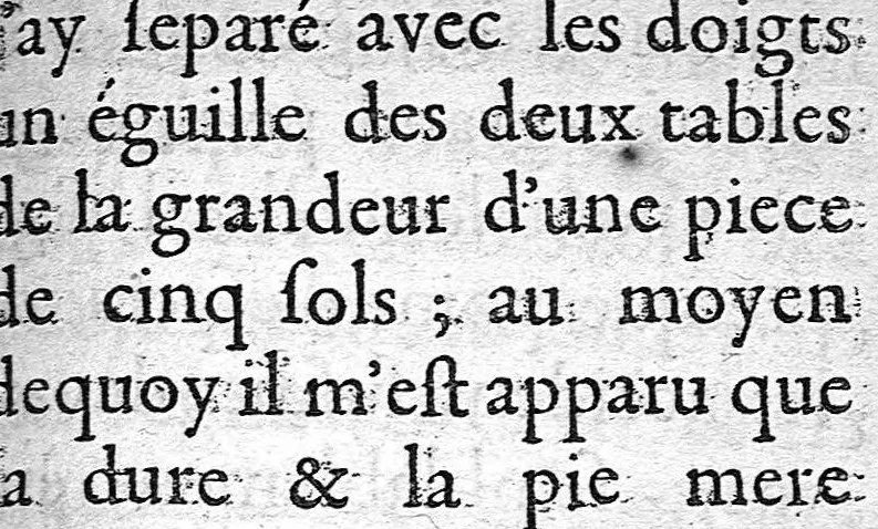 An illustration from La doctrine des raports de chirurgie fondée sur les maximes d'usage et sur la disposition des nouvelles ordonnances, 1684, leaf 167