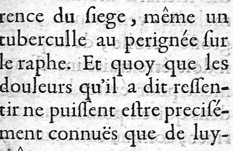 An illustration from La doctrine des raports de chirurgie fondée sur les maximes d'usage et sur la disposition des nouvelles ordonnances, 1684, leaf 271