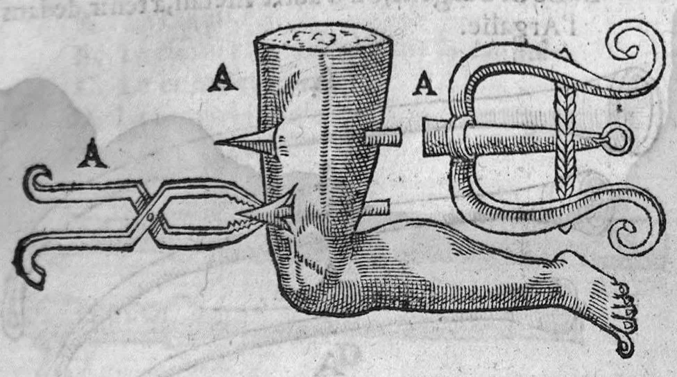 An illustration from Annotations de M. Laur. Joubert, sur toute la chirurgie de M. Gui de Chauliac. Avec l’interpretation des langues dudict Gui (c’est à dire, l’explication de ses termes plus obscurs) divisee en quatre Classes : la chascune estant rengee selon l’ordre de l’alphabet, 1584, leaf 386