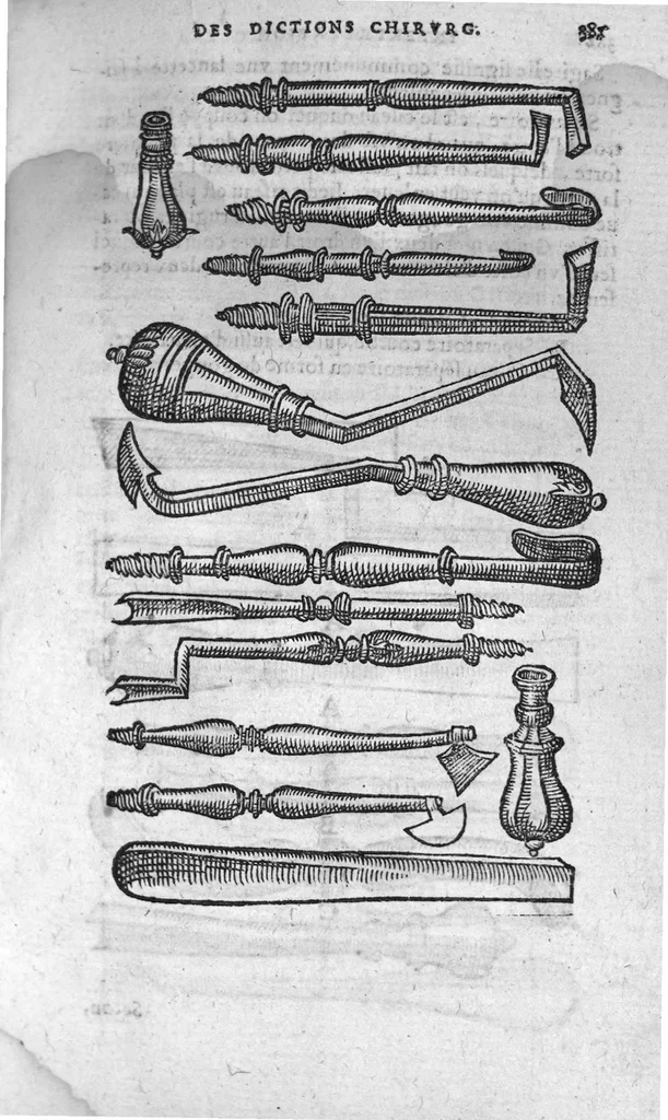 An illustration from Annotations de M. Laur. Joubert, sur toute la chirurgie de M. Gui de Chauliac. Avec l’interpretation des langues dudict Gui (c’est à dire, l’explication de ses termes plus obscurs) divisee en quatre Classes : la chascune estant rengee selon l’ordre de l’alphabet, 1584, leaf 412