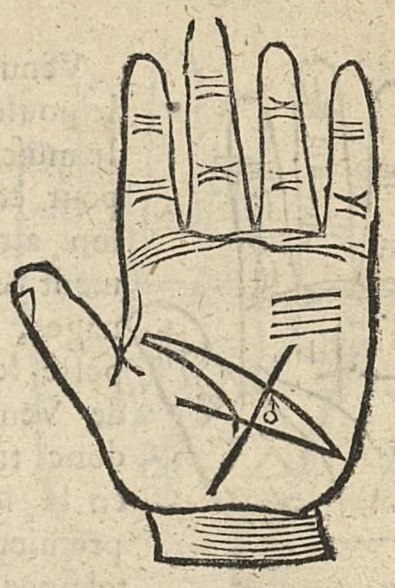An illustration from La Chiromance et phisiognomie par le regard des membres de l'homme..., le tout mis en françois par Antoine du Moulin masconnois, 1638, leaf 124