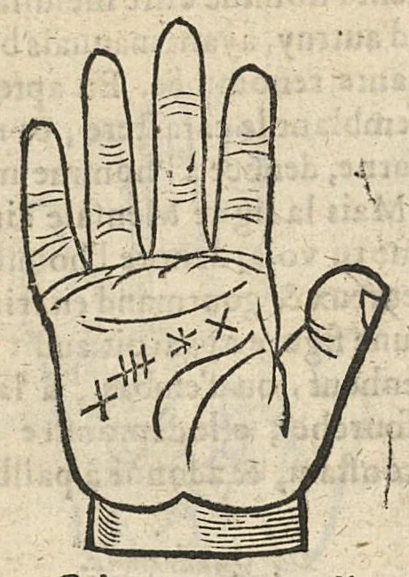 An illustration from La Chiromance et phisiognomie par le regard des membres de l'homme..., le tout mis en françois par Antoine du Moulin masconnois, 1638, leaf 77