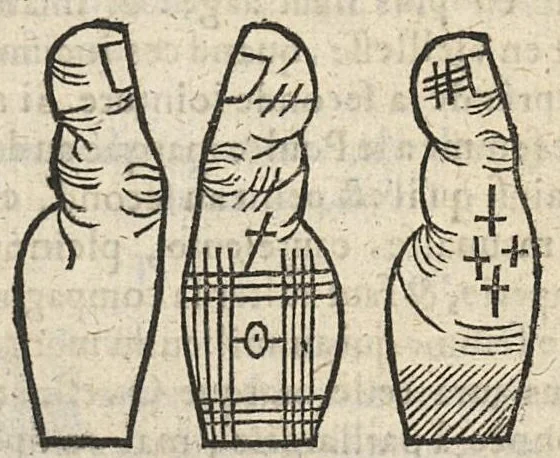 An illustration from La Chiromance et phisiognomie par le regard des membres de l'homme..., le tout mis en françois par Antoine du Moulin masconnois, 1638, leaf 88