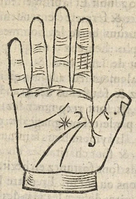 An illustration from La Chiromance et phisiognomie par le regard des membres de l'homme..., le tout mis en françois par Antoine du Moulin masconnois, 1638, leaf 95