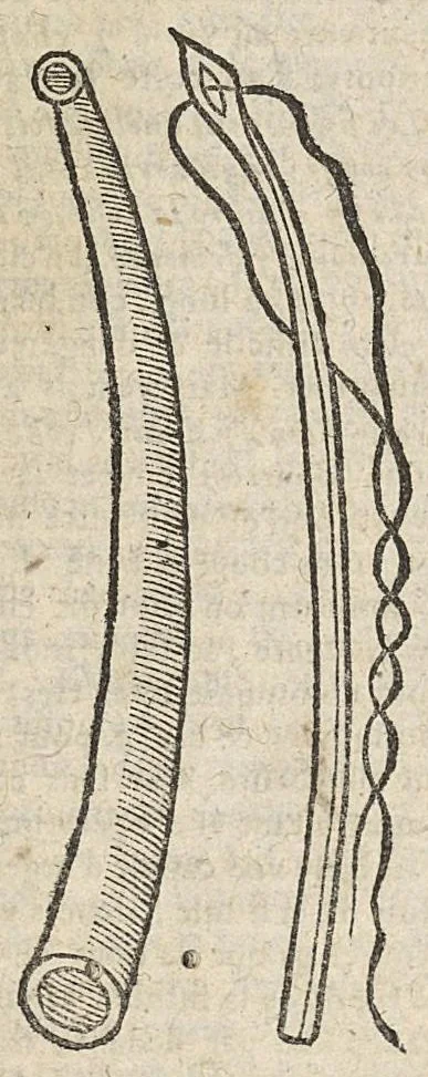 An illustration from Oeuvres chirurgicales...divisées en deux parties...derniere edition soigneusement reveue & enrichie de diverses figures inventées par l'autheur, 1658, leaf 667