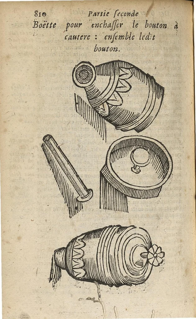 An illustration from Oeuvres chirurgicales...divisées en deux parties...derniere edition soigneusement reveue & enrichie de diverses figures inventées par l'autheur, 1658, leaf 825