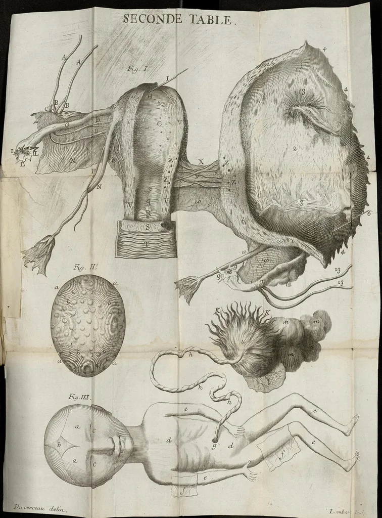 An illustration from Histoire anatomique d'une matrice extraordinaire, 1683, leaf 43