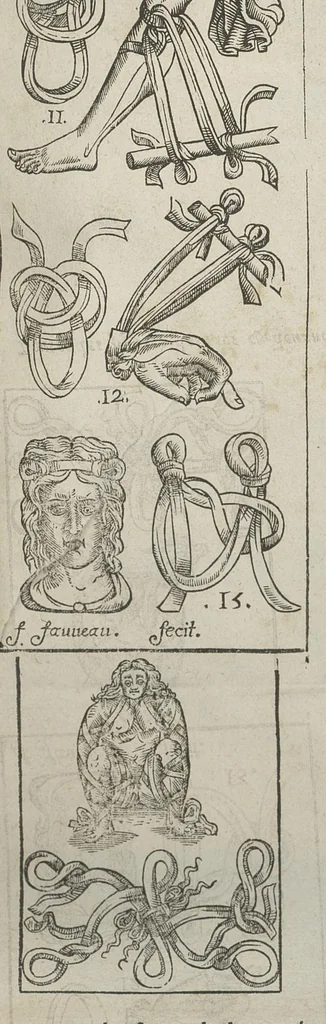 An illustration from L'Oeconomie chirurgicale, pour le restablissement des parties molles du corps humain. Contenant les principes de chirurgie, & un Traitté methodique de la garison de la peste, & de tous ses accidents, par le moyen d'un remede experimenté. Et nouvellement mis en lumiere..., 1671, leaf 725