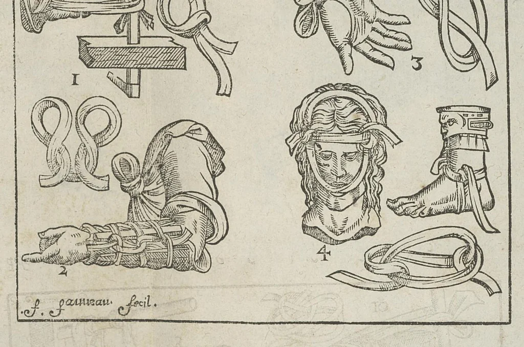 An illustration from L'Oeconomie chirurgicale, pour le restablissement des parties molles du corps humain. Contenant les principes de chirurgie, & un Traitté methodique de la garison de la peste, & de tous ses accidents, par le moyen d'un remede experimenté. Et nouvellement mis en lumiere..., 1671, leaf 725