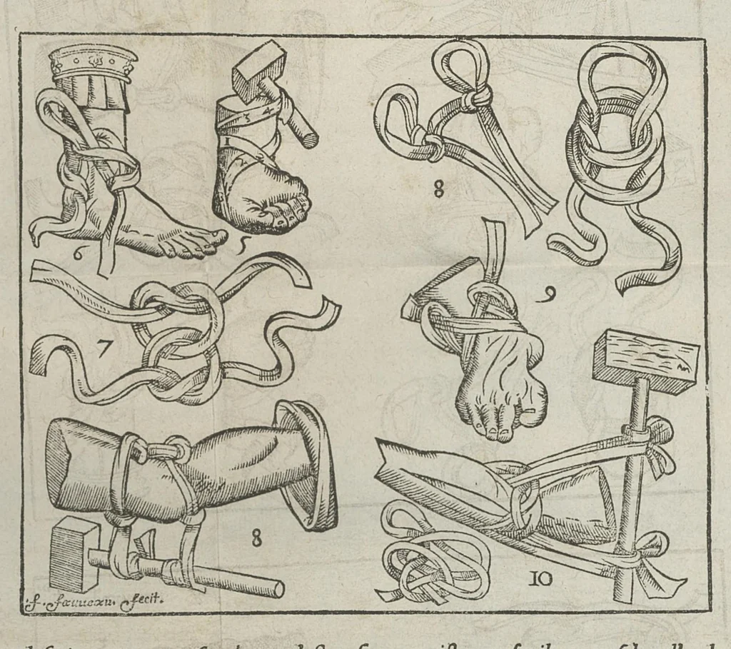 An illustration from L'Oeconomie chirurgicale, pour le restablissement des parties molles du corps humain. Contenant les principes de chirurgie, & un Traitté methodique de la garison de la peste, & de tous ses accidents, par le moyen d'un remede experimenté. Et nouvellement mis en lumiere..., 1671, leaf 725