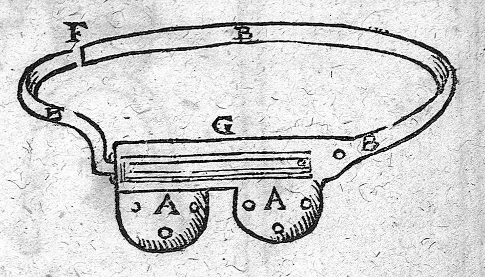 An illustration from Felicis Plateri quondam Archiatri et profess. Basil. Ordinarii praxeos medicae Tomi tres, 1625, leaf 989