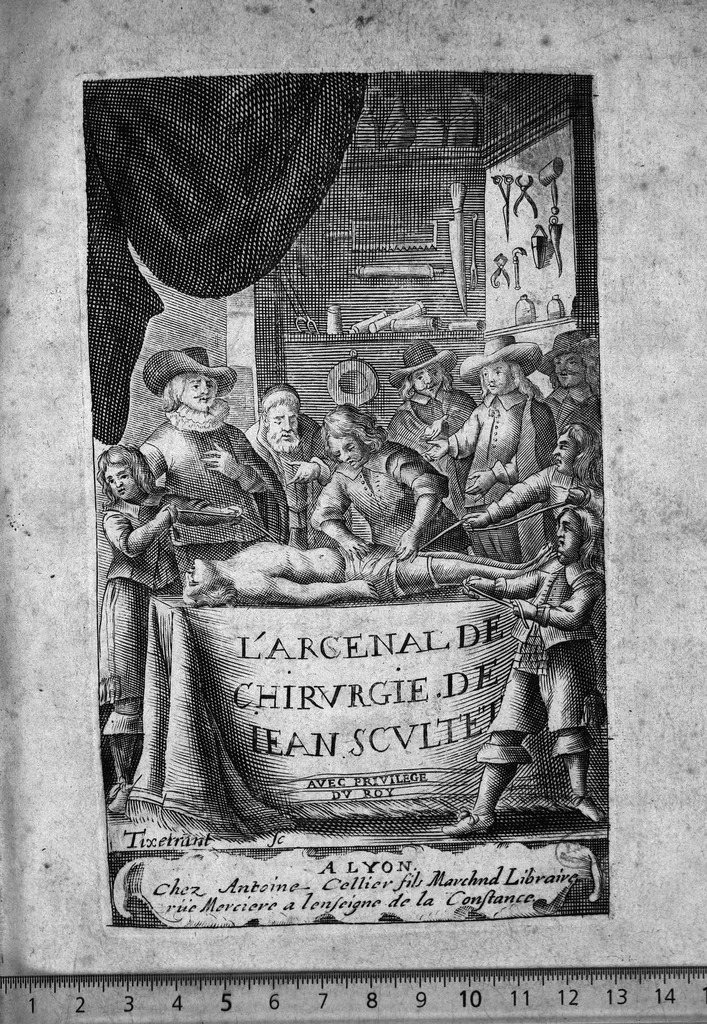 An illustration from L'arcenal de chirurgie, 1675, leaf 0
