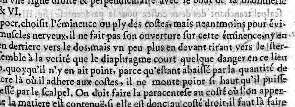 An illustration from L'arcenal de chirurgie, 1675, leaf 182