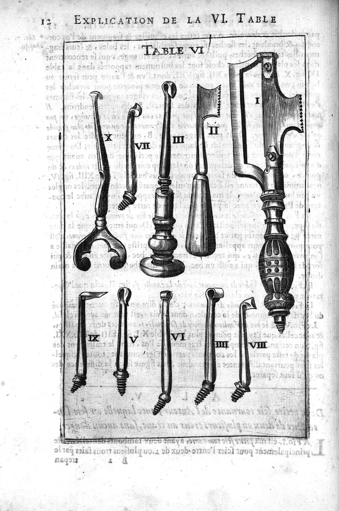 An illustration from L'arcenal de chirurgie, 1675, leaf 27