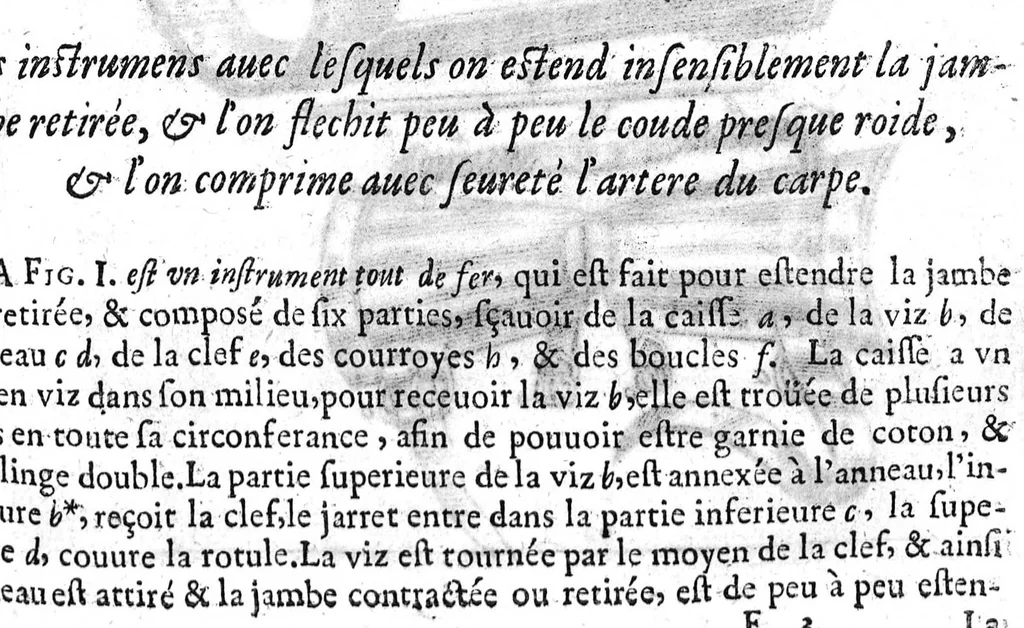 An illustration from L'arcenal de chirurgie, 1675, leaf 60