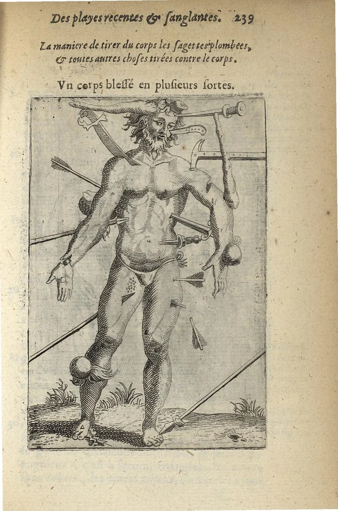 An illustration from Les Institutions chirurgiques, 1629, leaf 286