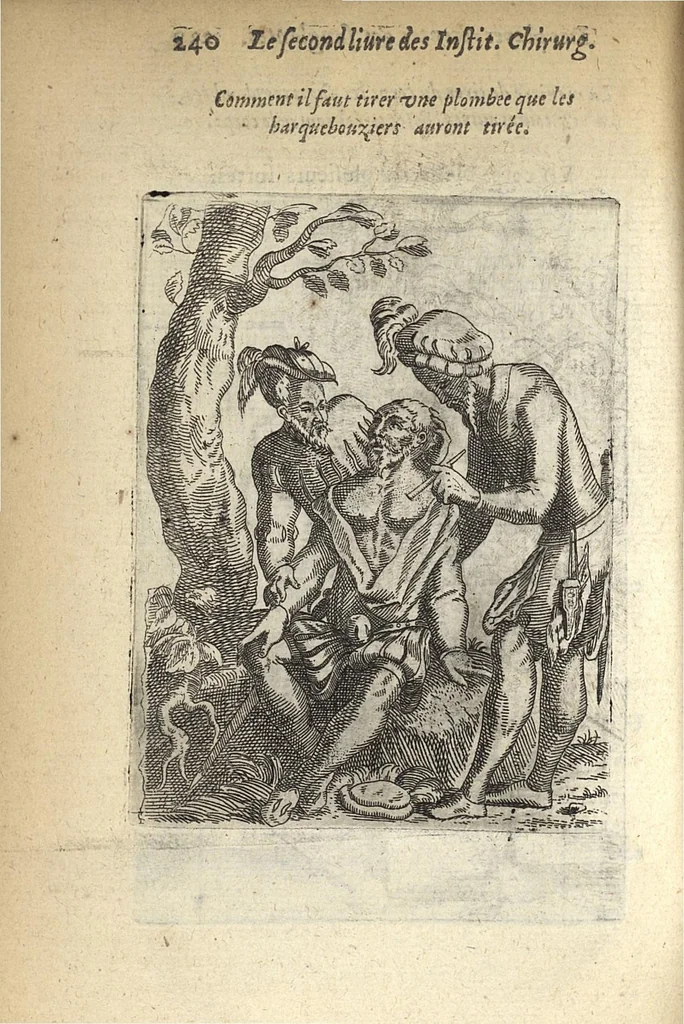 An illustration from Les Institutions chirurgiques, 1629, leaf 287