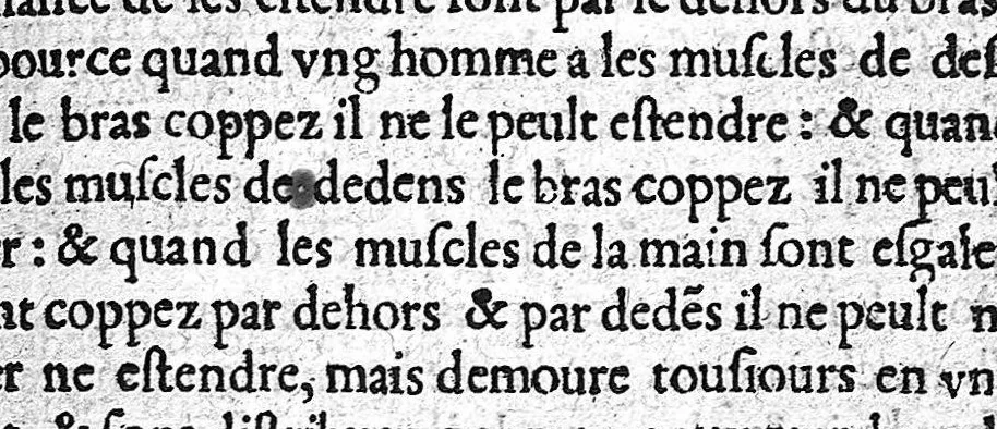 An illustration from De Vigo en françoys. La practique et cirurgie de excellent docteur en medecine Maistre Jehan de Vigo nouvellement imprimee et recogneue diligentement sur le latin avec les aphorismes et canons de cirurgie, composez par maistre Nicolas Godin docteur en medecine lesquelz sont inserez en la fin de ce present livre apres la partie compendieuse. Division de ladicte practique. La premiere partie est nommee la copieuse contenant neuf livres particuliers. La seconde est dicte compendieuse qui contient cinq livres particuliers : lesquelz sont declarez en la page sequente, 1542, leaf 47