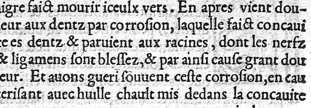 An illustration from De Vigo en françoys. La practique et cirurgie de excellent docteur en medecine Maistre Jehan de Vigo nouvellement imprimee et recogneue diligentement sur le latin avec les aphorismes et canons de cirurgie, composez par maistre Nicolas Godin docteur en medecine lesquelz sont inserez en la fin de ce present livre apres la partie compendieuse. Division de ladicte practique. La premiere partie est nommee la copieuse contenant neuf livres particuliers. La seconde est dicte compendieuse qui contient cinq livres particuliers : lesquelz sont declarez en la page sequente, 1542, leaf 639