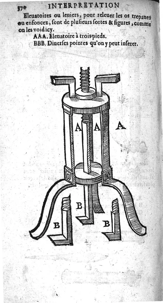 An illustration from Annotations...sur toute la chirurgie de M. Gui de Chauliac..suivie de Interprétation des langues...avec figures des instruments chirurgicaux..par Isaac Joubert, 1632, leaf 401