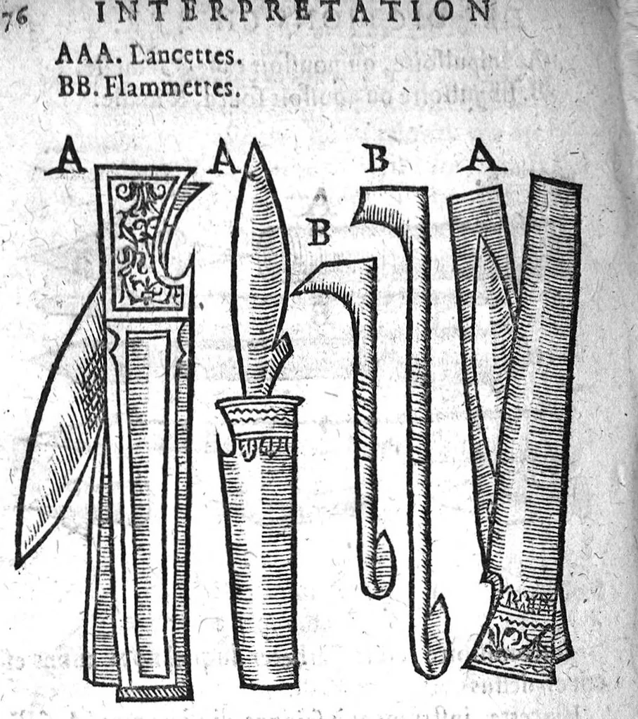 An illustration from Annotations...sur toute la chirurgie de M. Gui de Chauliac..suivie de Interprétation des langues...avec figures des instruments chirurgicaux..par Isaac Joubert, 1632, leaf 407