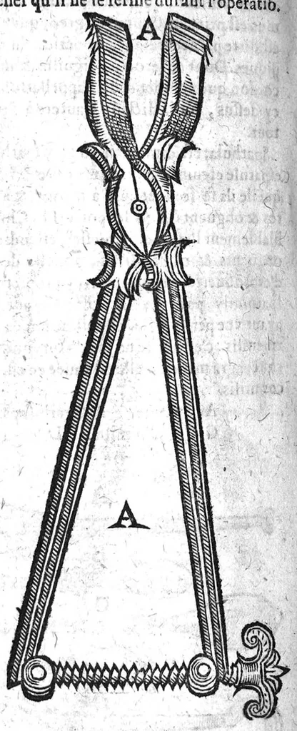 An illustration from Annotations...sur toute la chirurgie de M. Gui de Chauliac..suivie de Interprétation des langues...avec figures des instruments chirurgicaux..par Isaac Joubert, 1632, leaf 415