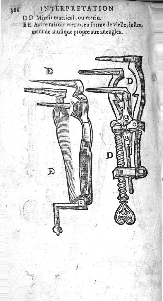An illustration from Annotations...sur toute la chirurgie de M. Gui de Chauliac..suivie de Interprétation des langues...avec figures des instruments chirurgicaux..par Isaac Joubert, 1632, leaf 417