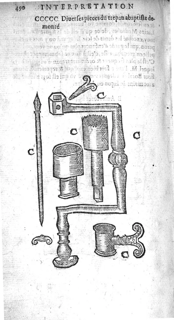 An illustration from Annotations...sur toute la chirurgie de M. Gui de Chauliac..suivie de Interprétation des langues...avec figures des instruments chirurgicaux..par Isaac Joubert, 1632, leaf 421