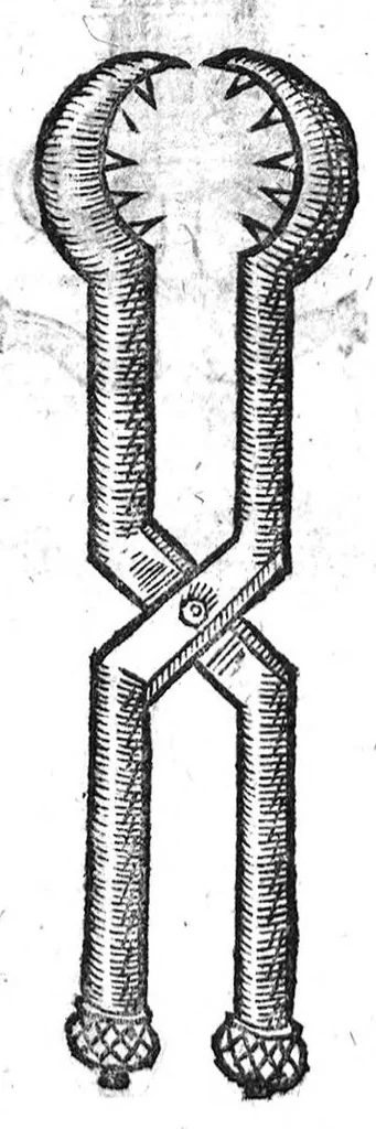 An illustration from Annotations...sur toute la chirurgie de M. Gui de Chauliac..suivie de Interprétation des langues...avec figures des instruments chirurgicaux..par Isaac Joubert, 1632, leaf 425