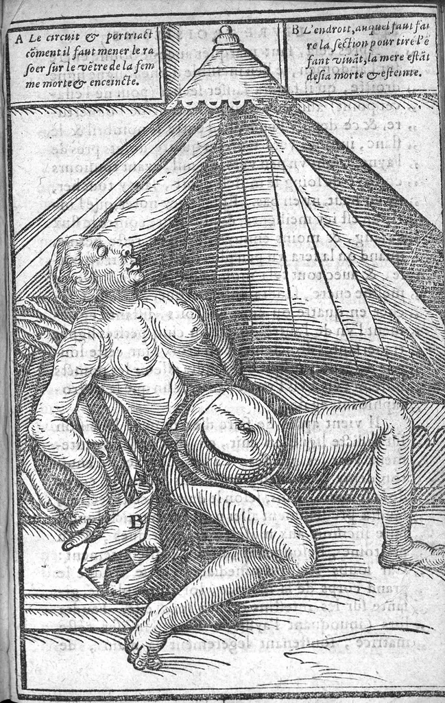An illustration from Des maladies des femmes et remedes d'ycelles en trois livres...traduits en françois & amplifiés par M. Jean Liebaud...augmentés du tiers par Lazare Pe., 1609, leaf 864