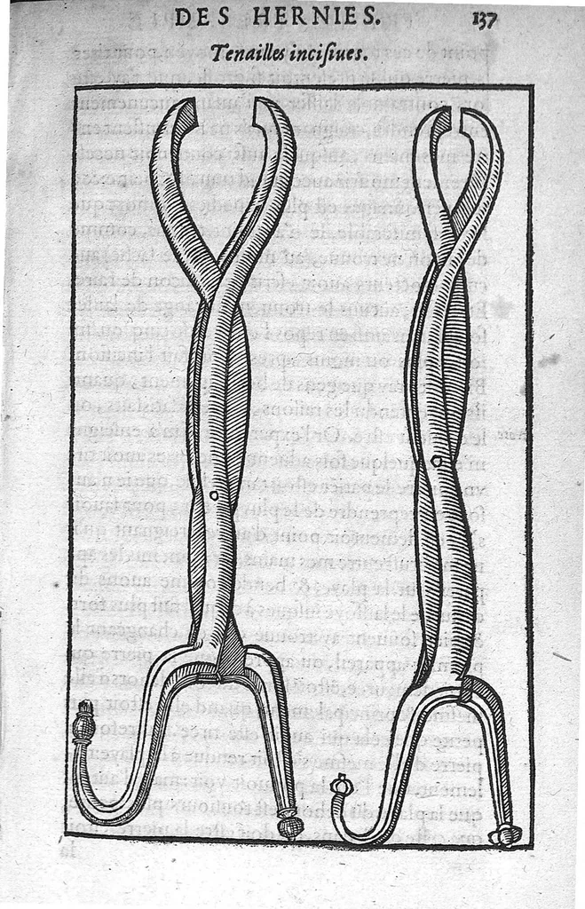 An illustration from Traité des Hernies contenant une ample declaration de toutes leurs especes, et autres excellentes parties de la Chirurgie,assavoir de la pierre, des cataractes des yeux, et autres maladies, desquelles comme la cure est perilleuse, aussi est elle de peu d’hommes bien exercée : Avec leurs causes, signes, accidens, anatomie des parties affectées, et leur entiere guarison : Par Pierre Franco de Turriers en Provence, demeurant à present à Orange, 1561, leaf 168