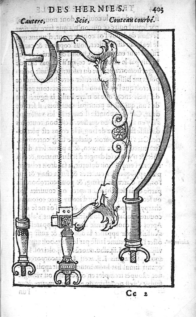 An illustration from Traité des Hernies contenant une ample declaration de toutes leurs especes, et autres excellentes parties de la Chirurgie,assavoir de la pierre, des cataractes des yeux, et autres maladies, desquelles comme la cure est perilleuse, aussi est elle de peu d’hommes bien exercée : Avec leurs causes, signes, accidens, anatomie des parties affectées, et leur entiere guarison : Par Pierre Franco de Turriers en Provence, demeurant à present à Orange, 1561, leaf 434