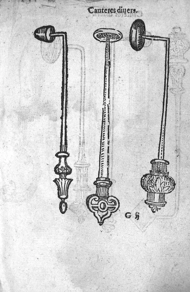 An illustration from Officinne et jardin de chirurgie militaire contenant les instrumentz et plantes tres necessaires a tous Chi[r]urgiens...avec certains cathalogues des ingrediens propres à chacun membre tant similaires qu’organiques. Dedié à haut et puissant seigneur M. François Gouffier, sieur de Crevecoeur Chevalier des deux ordres du Roy. Plus un traicté des contrepoisons et cure de la Peste et declaration d’un Enigme le tout experimenté et mis en lumiere pour l’utilité du public. Par Esaïe le Lievre Chirurgien,, 1583, leaf 98