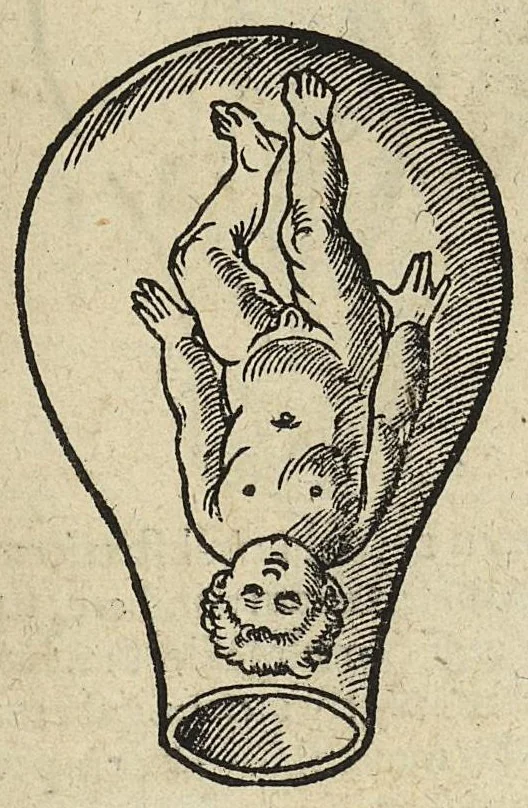 An illustration from De partu hominis, et quae circa ipsum accidunt. Libellus D. Eucharii Rhodionis, 1532, leaf 52