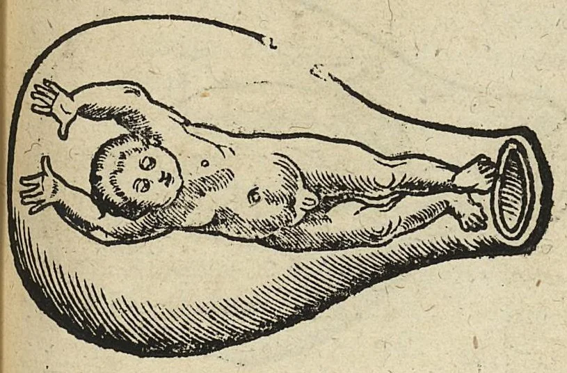 An illustration from De partu hominis, et quae circa ipsum accidunt. Libellus D. Eucharii Rhodionis, 1532, leaf 54