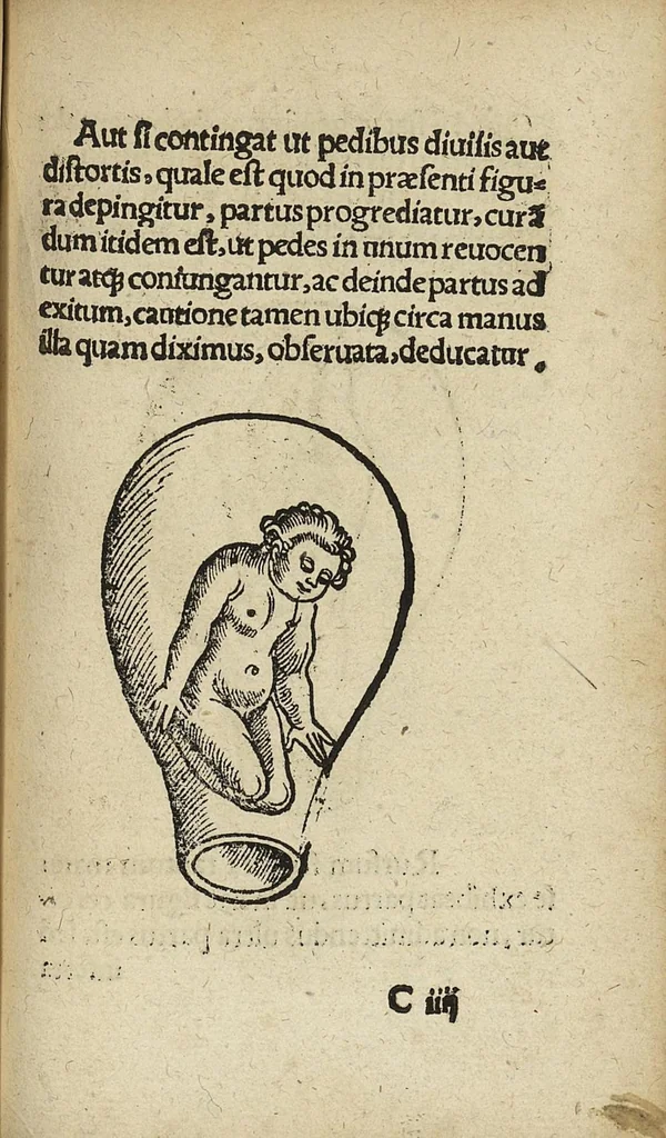 An illustration from De partu hominis, et quae circa ipsum accidunt. Libellus D. Eucharii Rhodionis, 1532, leaf 58
