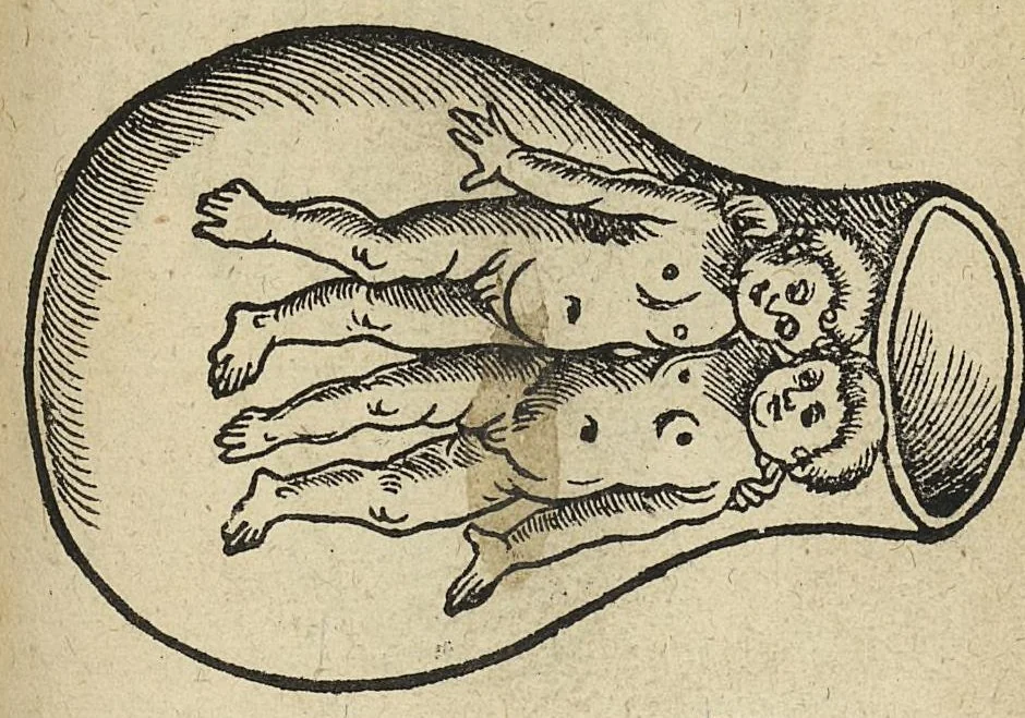 An illustration from De partu hominis, et quae circa ipsum accidunt. Libellus D. Eucharii Rhodionis, 1532, leaf 64