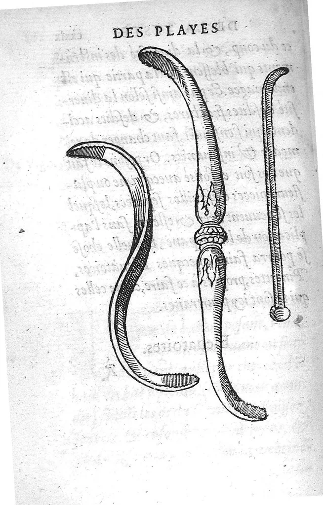 An illustration from La Methode Curative des Playes et Fracture de la teste humaine. Avec les pourtraits des Instruments necessaires pour la curation d’icelles. Par M. Ambroise Paré Chirurgien ordinaire du Roy, et Juré à Paris,, 1561, leaf 281