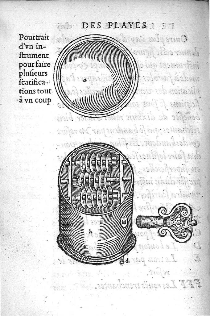 An illustration from La Methode Curative des Playes et Fracture de la teste humaine. Avec les pourtraits des Instruments necessaires pour la curation d’icelles. Par M. Ambroise Paré Chirurgien ordinaire du Roy, et Juré à Paris,, 1561, leaf 337