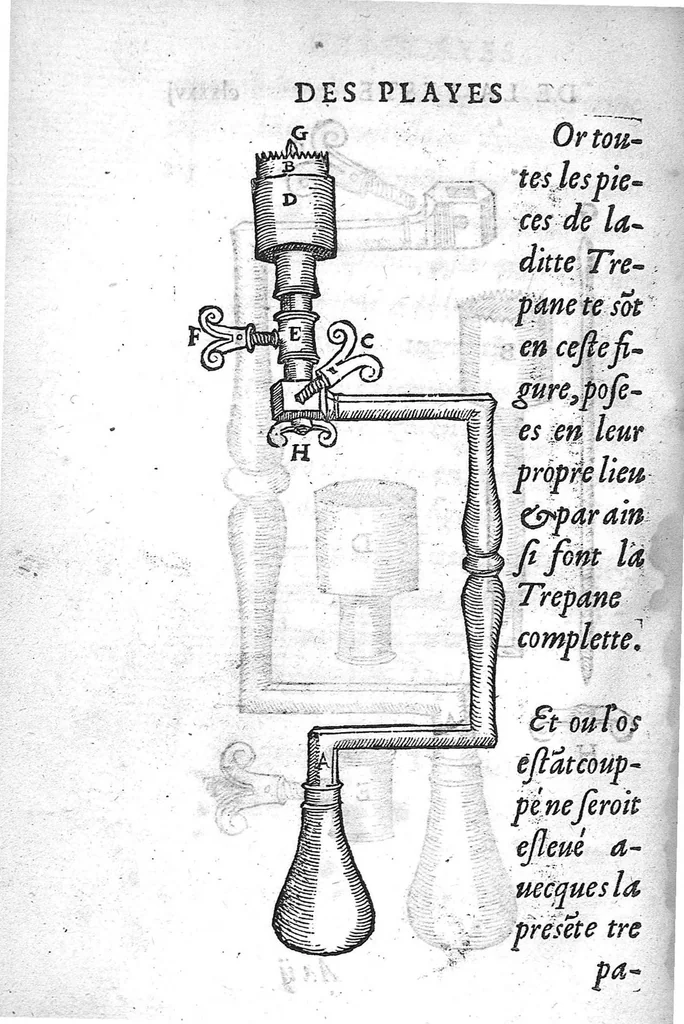 An illustration from La Methode Curative des Playes et Fracture de la teste humaine. Avec les pourtraits des Instruments necessaires pour la curation d’icelles. Par M. Ambroise Paré Chirurgien ordinaire du Roy, et Juré à Paris,, 1561, leaf 395